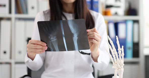 Professional Doctor Conducting Xray Diagnostics of Bones of Hands in Clinic