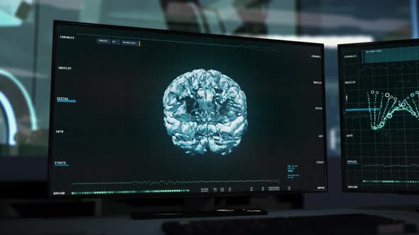 Advanced patient examination software interface is thoroughly scanning brain alt