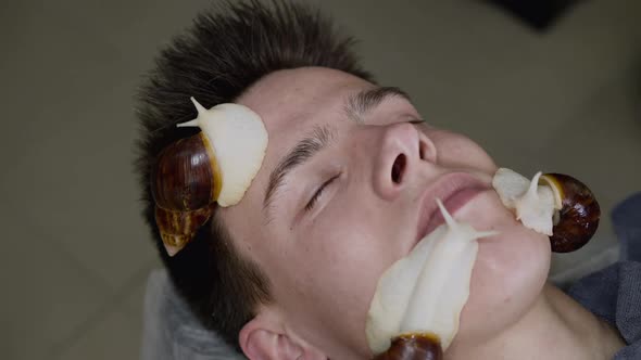 Man Receiving Facial Skin Rejuvenation During a Treatment with Crawling Snails