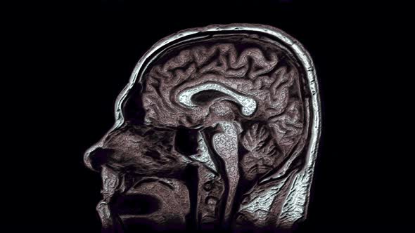 Voluminous Color MRI Scans of the Brain and Head To Detect Tumors. Diagnostic Medical Tool