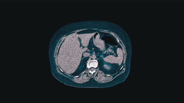 Voluminous Color MRI of the Abdominal Cavity, Gastrointestinal Tract, Bladder