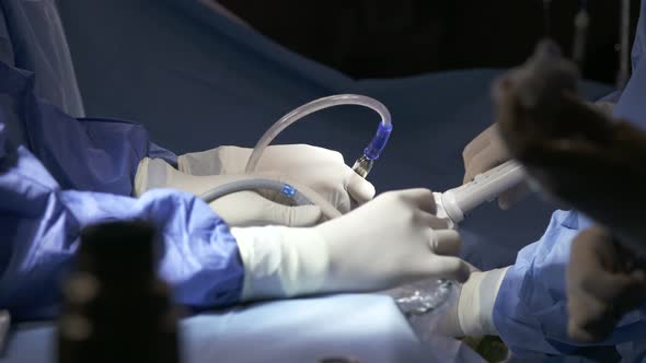 Surgeons working during surgery, close up on hands and instruments.