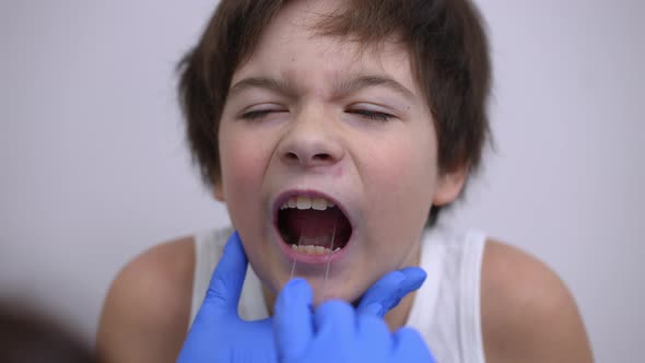 Closeup Face of Ill Caucasian Boy Opening Mouth As Unrecognizable Doctor Checking Oral Cavity with