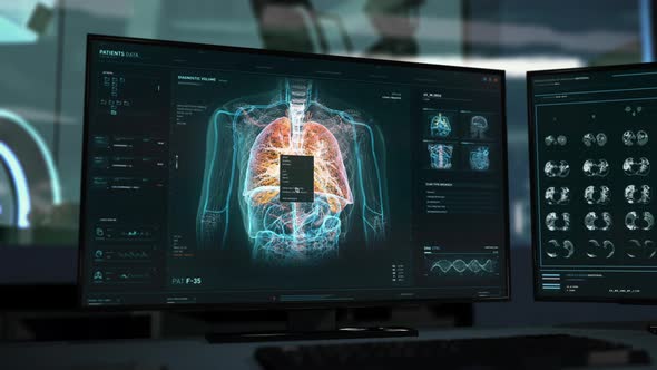 Molecular Analysis Software In Hospital Checks Respiratory Organ For Illness alt