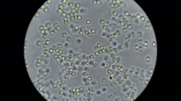 Yeast Under the Microscope