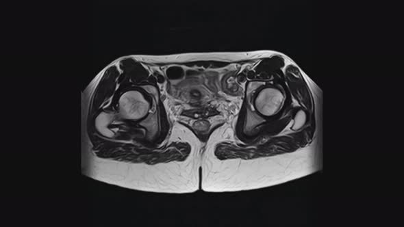 MRI of the Female Pelvic Organs, Abdominal Cavity, Gastrointestinal Tract and Bladder