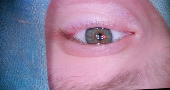 Close Up Screen View Eye During Eye Surgery