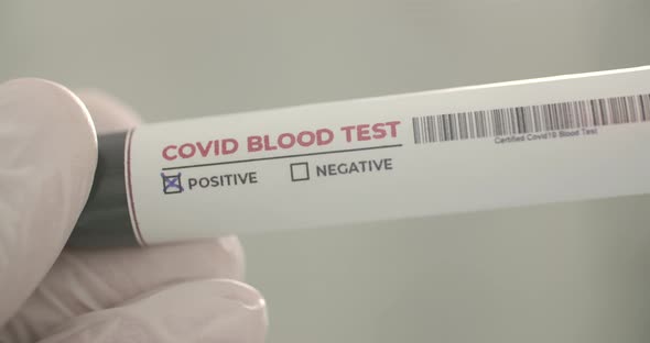 Positive Covid 19 Blood Test