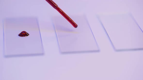 Lab Assistant Putting Drop of Blood on Glass Slide for Test Close Up