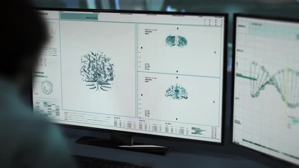 Advanced Oncology Scanner Used In A Neurological Diagnosis Of A Brain Tumor