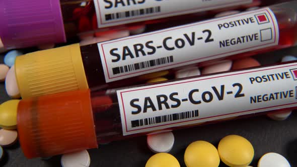 Sars Cov2 blood test tube