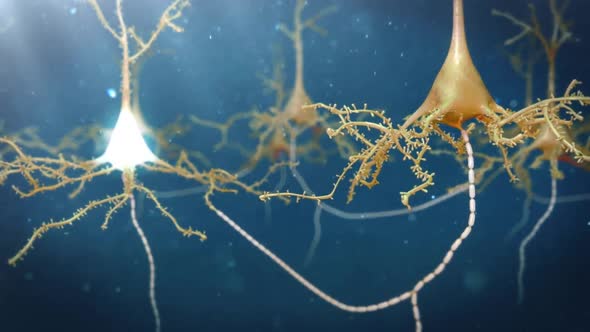 Neurons With Amyloid Plaques, Animation