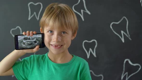 Closeup Shot of a Little Boy with Missing Milk Teeth Showing His X-ray Dental Picture. Concept of