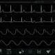 Cardiac Monitor (Themplate+4 waveforms, alpha) - VideoHive Item for Sale