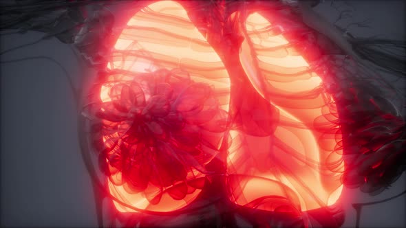 Human Lungs Radiology Exam alt