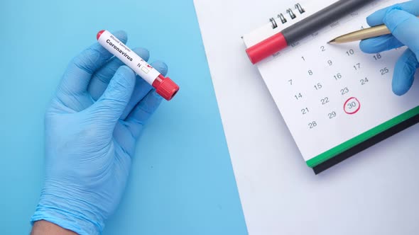 Holding Blood Test Tube and Marking Date on Calendar