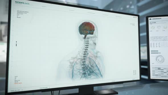 Futuristic Scanner is examining the structure of the human brain at the hospital alt
