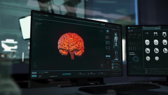 Human Brain Biology Analysis At Modern Medical Clinic Diagnosed Tumor Disease alt