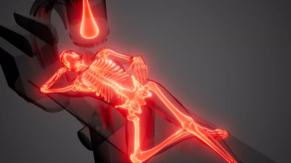 X-ray Examination Medical Scan Footage alt