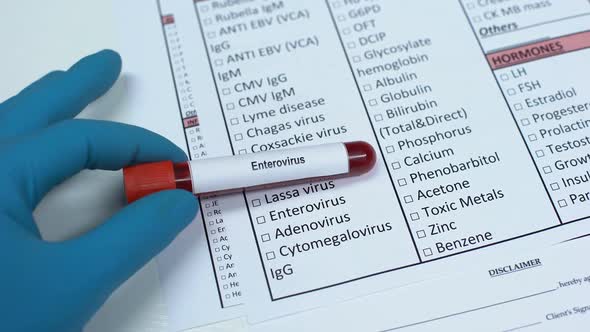 Enterovirus, Doctor Checking Disease in Lab Blank, Showing Blood Sample in Tube