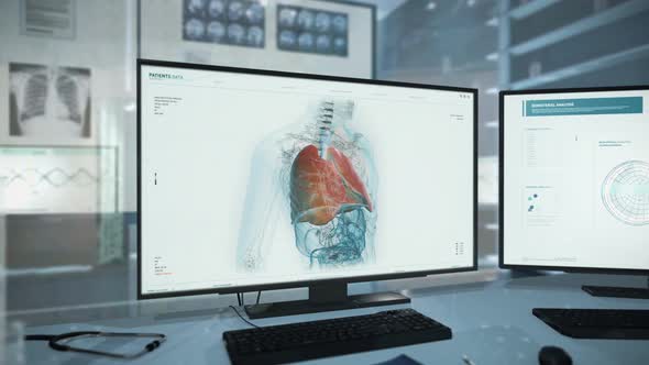 Patient Lungs Medical Research Results In Advanced Medical Scan Program alt