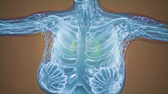 Mammogram Radio Imaging for Breast Cancer Diagnosis alt