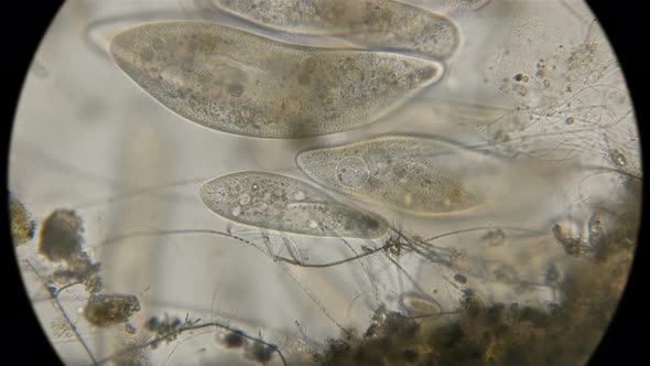 colony Infusorium Paramcium caudtum, under a microscope 