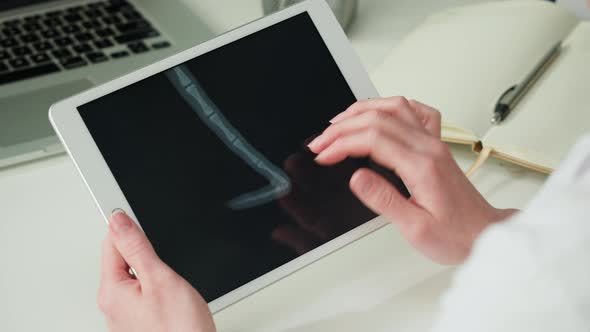 Doctor Veterinarian Examining Skeleton Roentgen Closeup