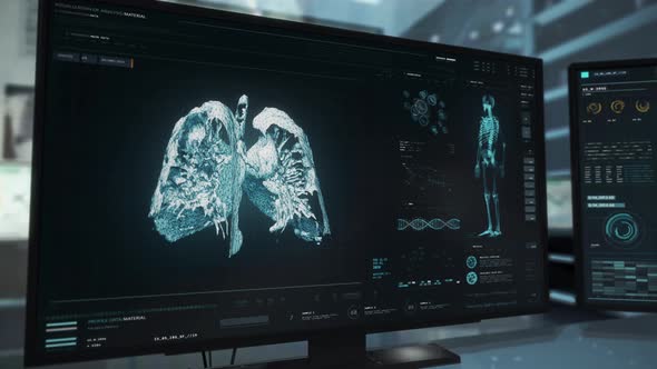 Medical Cancer Therapy Interface Used For Modern Human Health Care Treatment alt