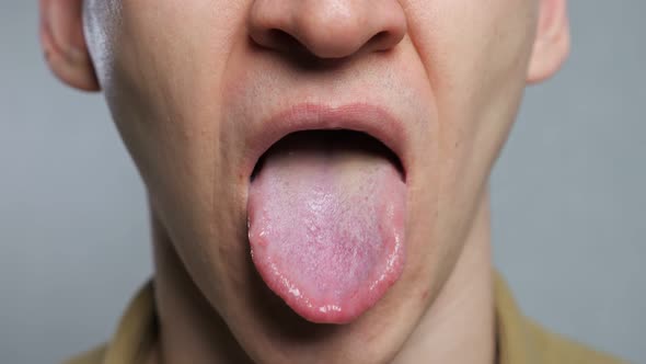 Unrecognizable Man Shows Infection Tongue