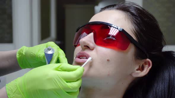 Closeup View of the Dentist's Hands Taking on Special Protective Treatment on the Lips of a Female