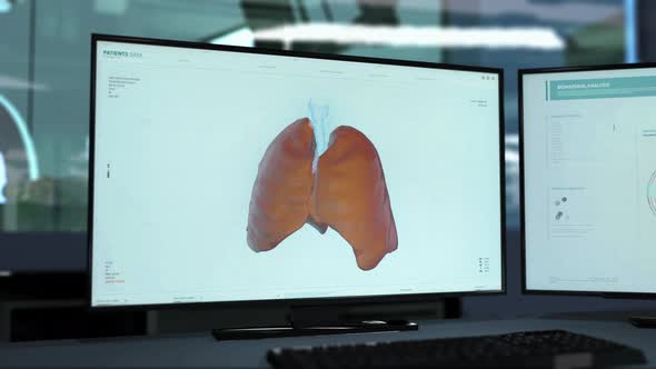 Futuristic scanner diagnoses emergency patient with Lung Cancer at the hospital