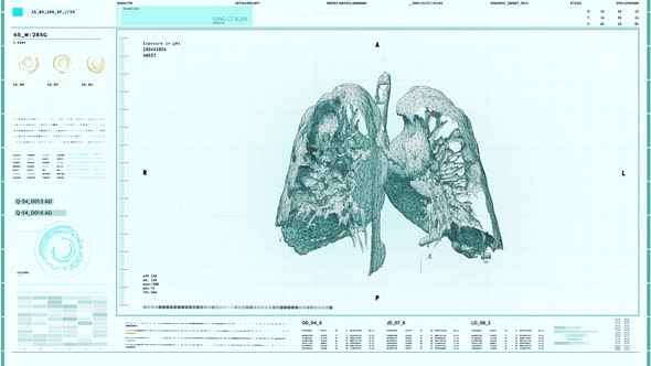 Innovative Medicine X-ray Scanner Diagnoses Cancer By Examining Patients Lungs alt