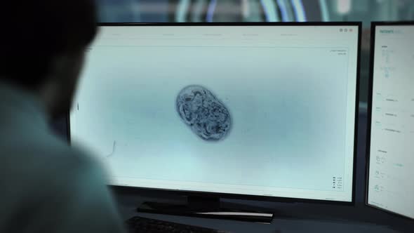 Microscopic Biology Study Of Bacterial Mitosis Process Overseen By Scientist alt