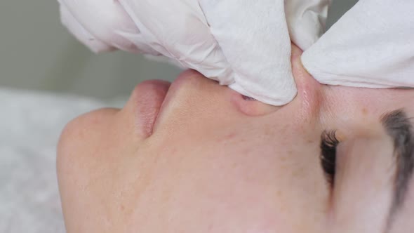 Doctor Beautician in a Black Mask Makes Cleaning the Face of a Young Woman