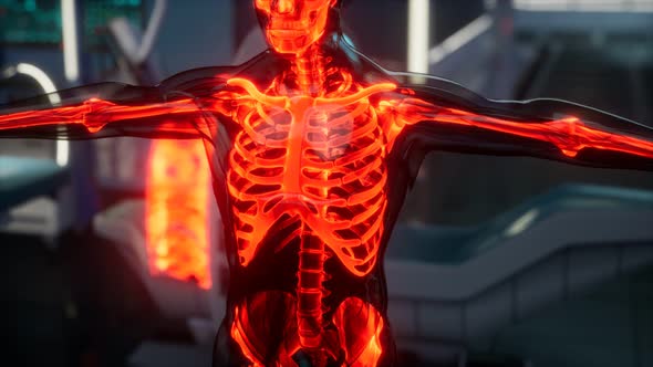 Human Skeleton Bones Scan Exam in Lab