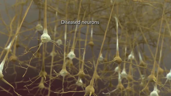 Motor Neuron Disease classifies a group of disorders that affect muscle activity.