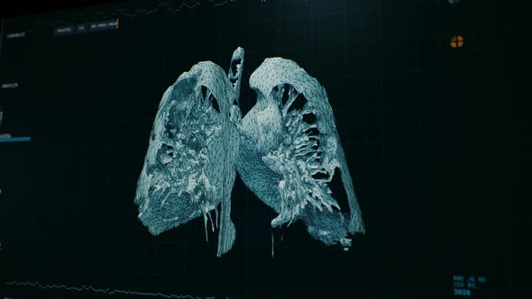 Modern medical user interface. 3D lung creating on Computer screen. Modern CT