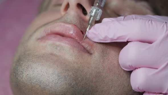 Man Getting Beauty Injection for Lips