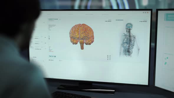 Medical Doctor Makes Brain Diagnosis With A Modern Scientific Software alt