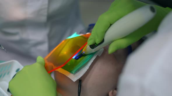 Closeup Dental Assistant Using Dental Curing Light in Slow Motion in Stomatological Clinic