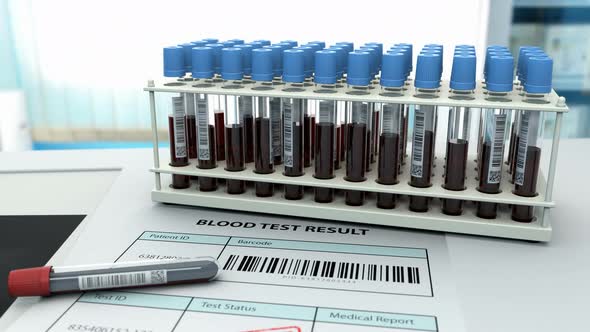 Lung X-ray After Blood Test To Make Diagnosis 4k alt