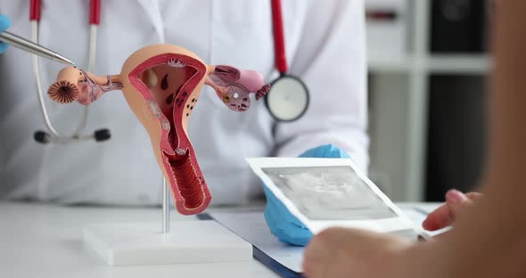 Gynecologist Demonstrates Model of Female Reproductive System to Woman in Clinic After Ultrasound of