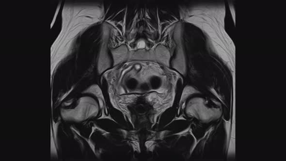 MRI of the Female Pelvic Organs, Abdominal Cavity, Gastrointestinal Tract and Bladder