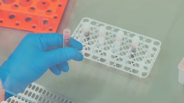 Work on Samples of Substances is Carried Out in the Laboratory alt