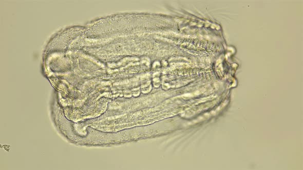 Black Sea Plankton and Zooplankton Under a Microscope,, the Larva of Beroe Ovata, Phylum Ctenophora alt