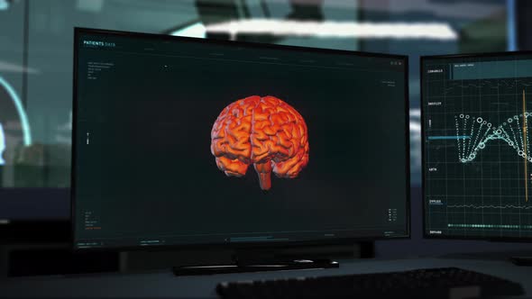 Interface of the diagnostic software detecting deadly brain tumor in a patient alt